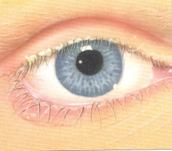 Blefaritis Ocularis