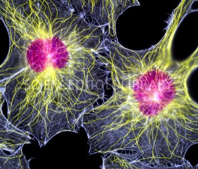 ^BFibroblast cells.^b Fluorescent light micrograph of two fibroblast cells, showing their nuclei (purple) and cytoskeleton. The cytoskeleton is made up of microtubules of the protein ^Itubulin^i (yellow) and filaments of the protein ^Iactin^i (blue). The cytoskeleton supports the cell's structure, allows the cell to move and assists in the transport of organelles and vesicles within the cell. Fibroblasts are cells forming connective tissue, and are responsible for secreting connective tissue proteins such as collagen. Magnification: x980 when printed 10cm wide.